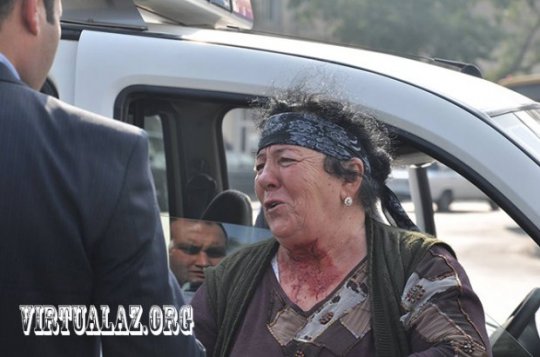 Polislər çaysatan qadını boğaza yığdı, o da boğazını stəkan qırığı ilə kəsdi - (Fotolar)