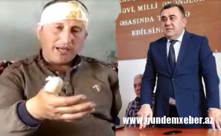 Goranboyda icra başçısının müavini şikayətçini döyüb pəncərədən aşağı tulladı – Sakin DTX-nın rayon şöbəsinə sığındı (Video)