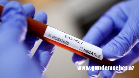 Gürcüstanda koronavirusa yoluxanların sayı 1 070-i ötdü