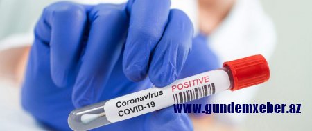 Azərbaycanda koronavirusa yoluxma sayı 129-a düşüb, 421 nəfər sağalıb