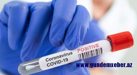 Gürcüstanda koronavirusa yoluxanların sayı 15 nəfər artdı