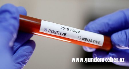 Azərbaycanda daha 273 nəfərin koronavirusa yoluxduğu aşkarlandı
