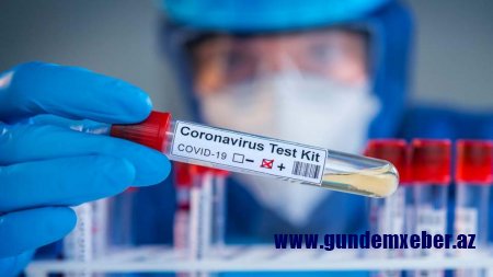 Azərbaycanda daha 590 nəfər koronavirusa yoluxub, 7 nəfər vəfat edib