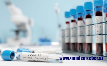 Gürcüstanda daha 478 nəfər koronavirusa yoluxub, 6 pasiyent vəfat edib