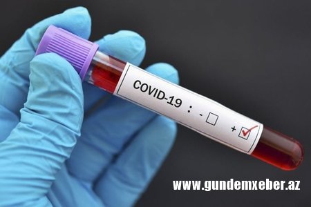 Gürcüstanda daha 2504 nəfər koronavirusa yoluxub, 36 nəfər ölüb