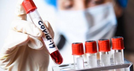 Azərbaycanda daha 2 186 nəfər koronavirusa yoluxub, 14 nəfər ölüb