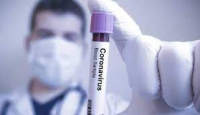 Gürcüstanda daha 392 nəfər koronavirusa yoluxub