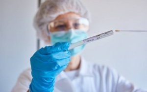Azərbaycanda daha 11 nəfər koronavirusa yoluxub, ölən olmayıb