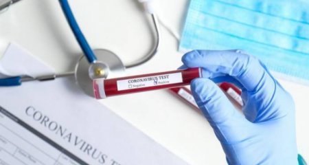 Azərbaycanda son sutkada 155 nəfər koronavirusa yoluxub - 1 nəfər vəfat edib