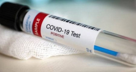 Son sutkada Azərbaycanda 41 nəfər koronavirusa yoluxub, 1 nəfər ölüb
