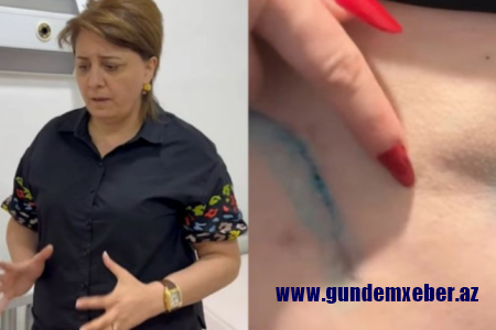 Prokurorluqda pasiyentin ölüm işində adı keçən həkim yenidən cərrahlıq edir? – VİDEO