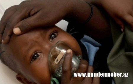 Nigeriyada "Lassa" qızdırmasından 162 nəfər ölüb
